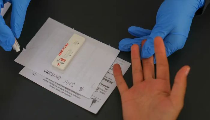 © Fabio Rodrigues-Pozzebom/ Agência Brasil HIV/Aids: Brasil vai insistir em acordo por PrEP de longa duração